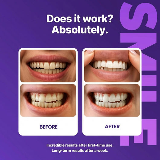 Purple Whitening Strips